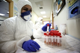 Russian Scientists Develop Immunity Tests Against COVID-19