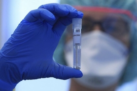Azerbaijan Greenlights Clinical Trials of Combined Covid-19 Vaccine