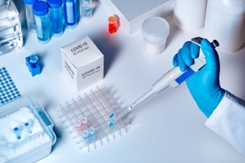 Production of Domestic PCR Tests for COVID-19 Starts in Azerbaijan