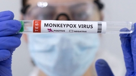 Azerbaijan Receives Monkeypox Test Kits from WHO